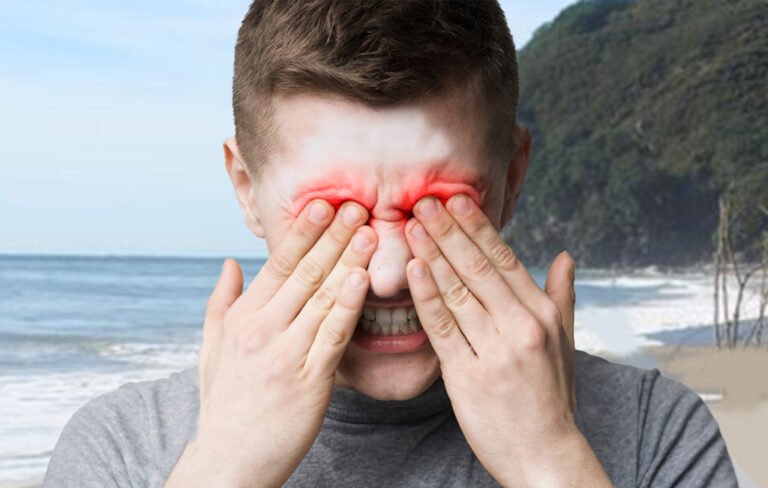 Cam Jones rubbing sunscreen into his eyes.