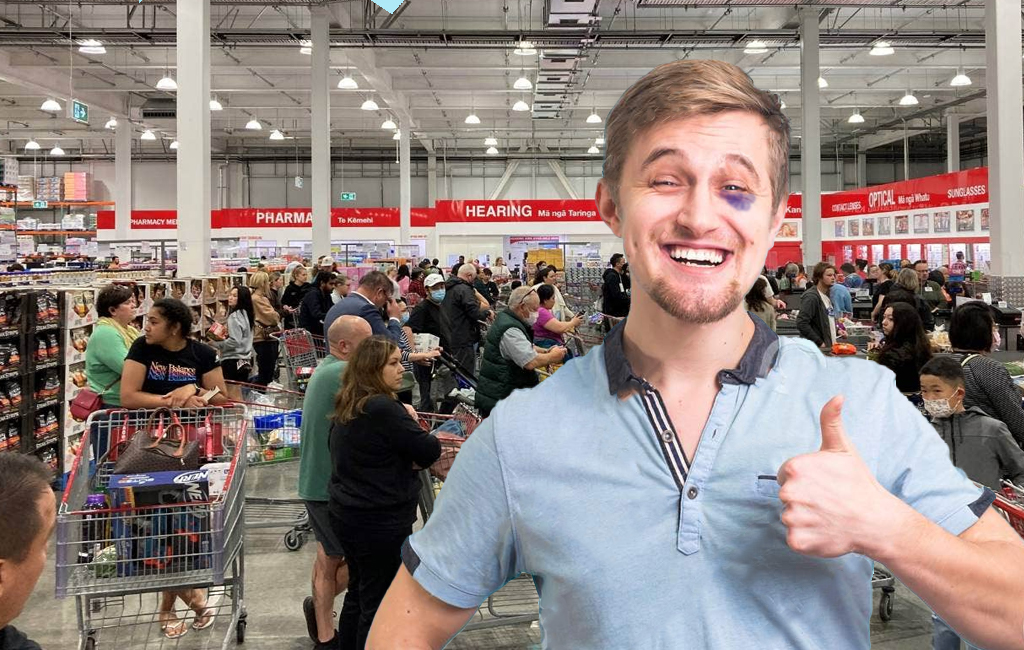 Man with black eye at Costco