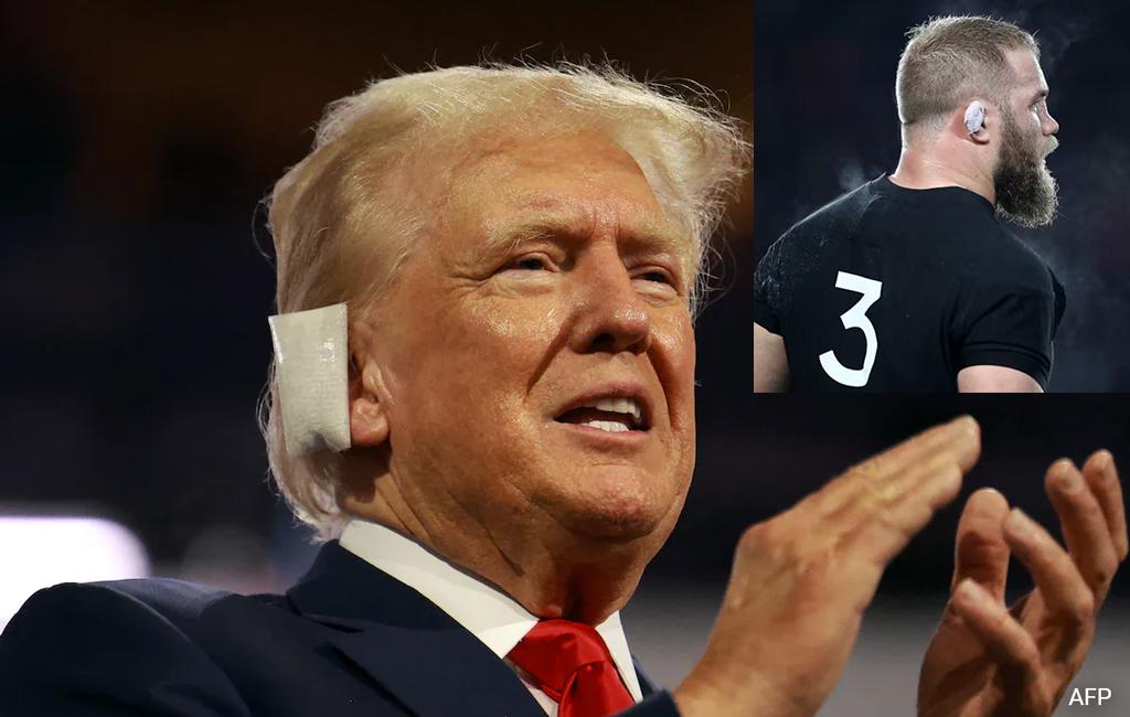 Donald Trump with bandaged ear compared to All Black front rower