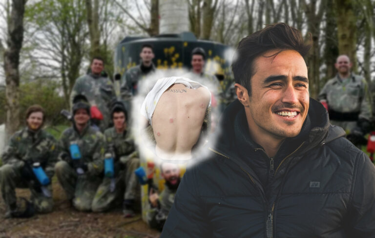 man thinking about his paintball welts